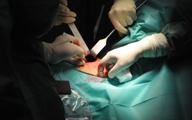 Lekarze na sali operacyjnej podczas pierwszej w Polsce operacji robotyczna tarczycy z dojściem przez pachę w Wojskowym Instytucie Medycznym