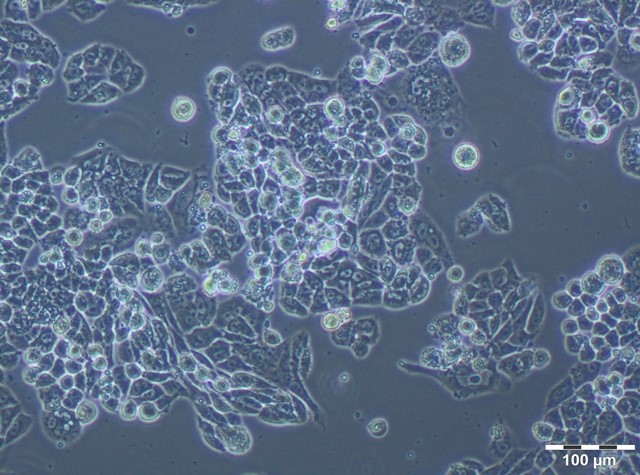 Jedna z lekoopornych linii komórkowych A16PTX pod mikroskopem