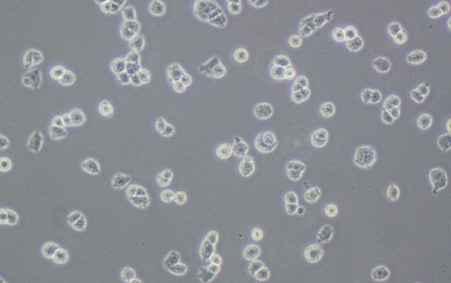 Linia macierzysta komórek ludzkiego raka jajnika A2780 pod mikroskopem