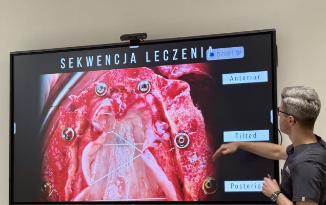 Lekarz prezentuje na wyświetlaczu sekwencje leczenia. Na wyświetlaczu obraz jamy ustnej wraz kolejno zaplanowanymi zabiegami.