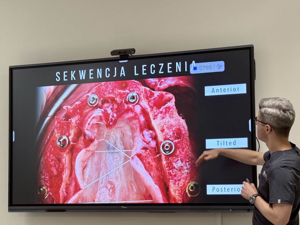 Lekarz prezentuje na wyświetlaczu sekwencje leczenia. Na wyświetlaczu obraz jamy ustnej wraz kolejno zaplanowanymi zabiegami.
