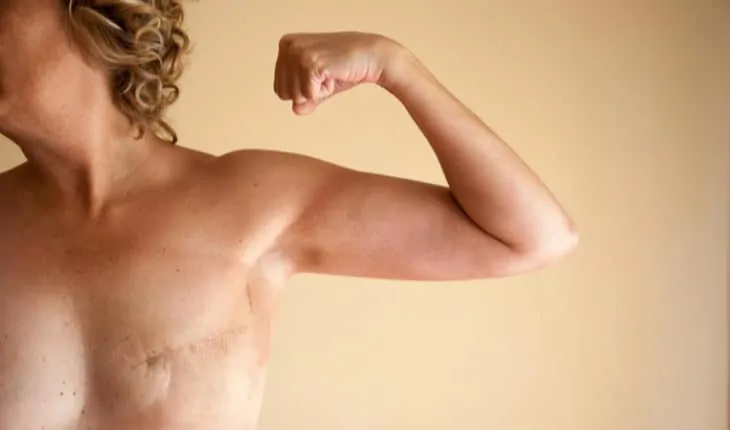 fragment sylwetki kobiety po mastektomii napinającej biceps.