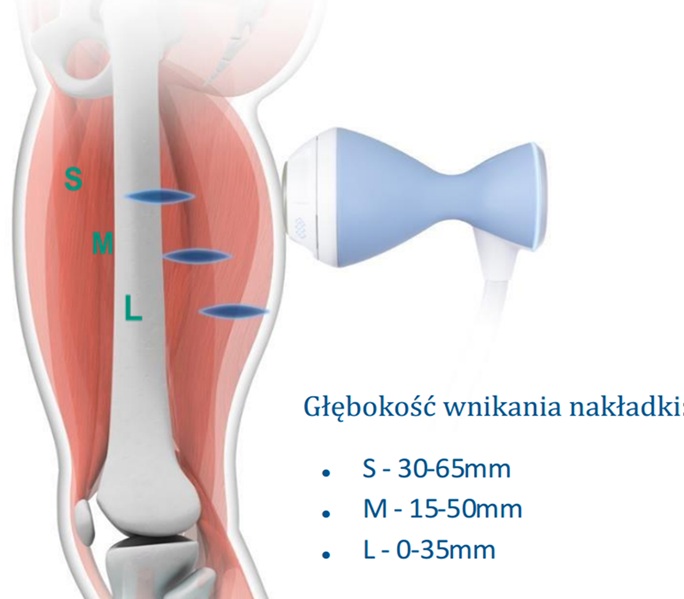 Grafika kończyny dolnej i nakładki urządzenia fali uderzeniowej. Napis: "Głębokość wnikania nakładki: s - 30-65 mm, m - 15-50 mm, l - 0-35 mm"