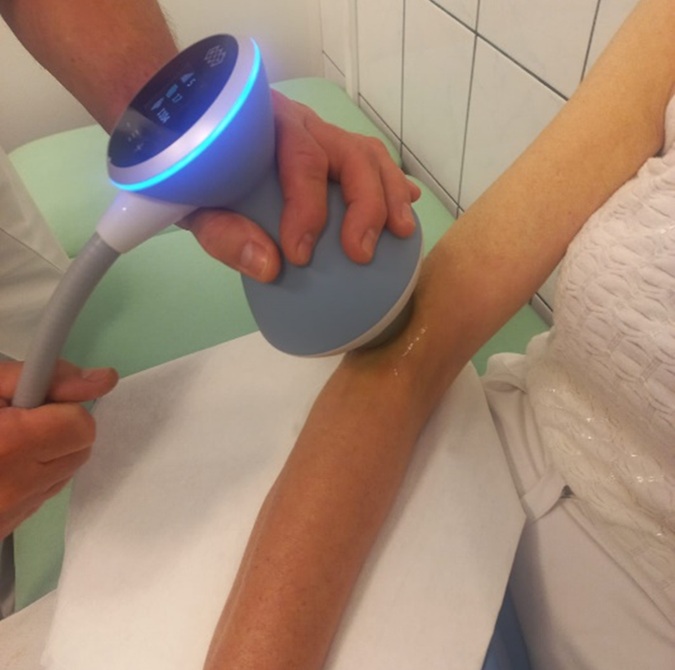 Zabieg urządzeniem fali uderzeniowej. Ujęcie kończyny górnej i urządzenia fali uderzeniowej w rękach pracownika.