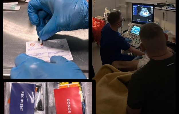 Kolaż zdjęć: Kolaż 2 zdjęć. Pierwsze zdjęcie: Ujęcie na dłonie w niebieskich rękawiczkach lateksowych podczas wypełniania dokumentacji badań krwi. Drugie zdjęcie: Zestawy medyczne dla biorcy i dawcy, trzecie zdj ecie: badanie usg w sali szpitalnej.