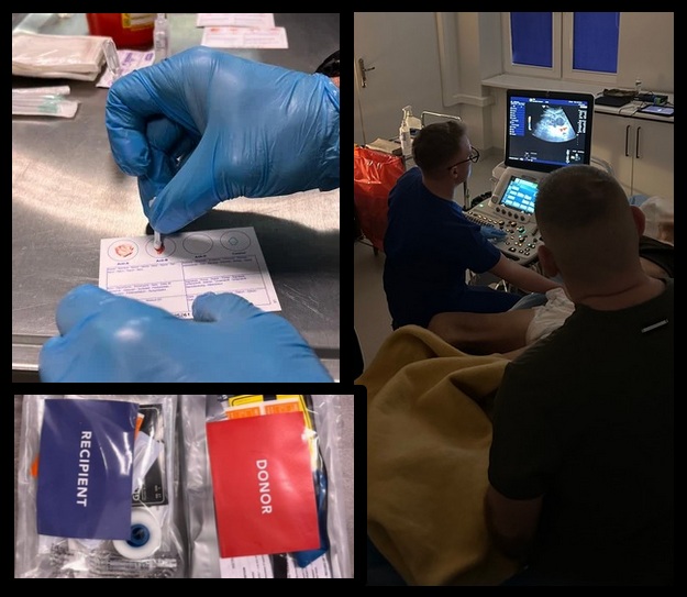 Kolaż zdjęć: Kolaż 2 zdjęć. Pierwsze zdjęcie: Ujęcie na dłonie w niebieskich rękawiczkach lateksowych podczas wypełniania dokumentacji badań krwi. Drugie zdjęcie: Zestawy medyczne dla biorcy i dawcy, trzecie zdj ecie: badanie usg w sali szpitalnej.