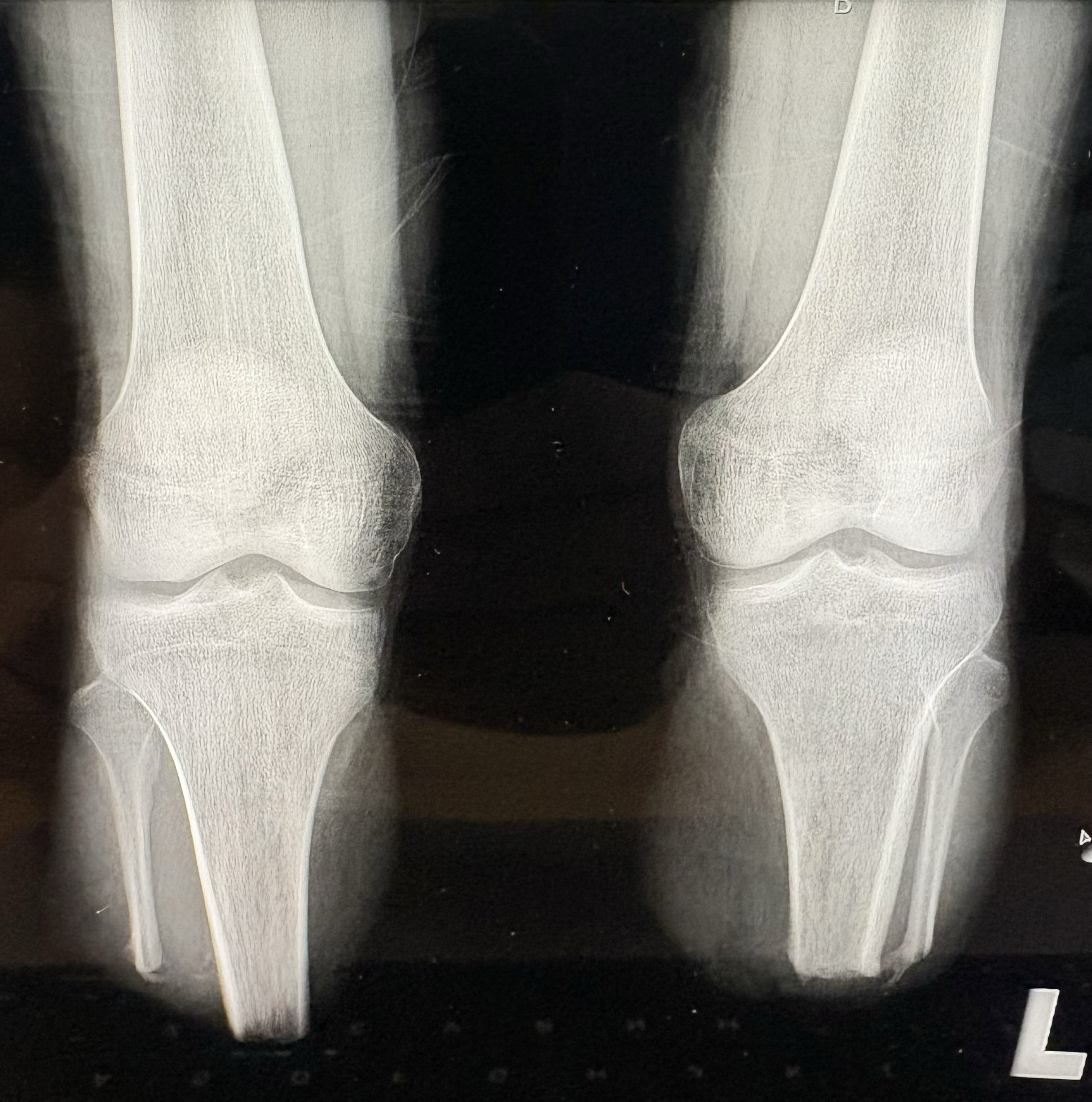 Zdjęcie RTG kończyn.