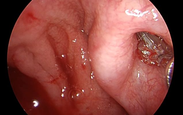 Zdjęcie z kamery operacyjnej.