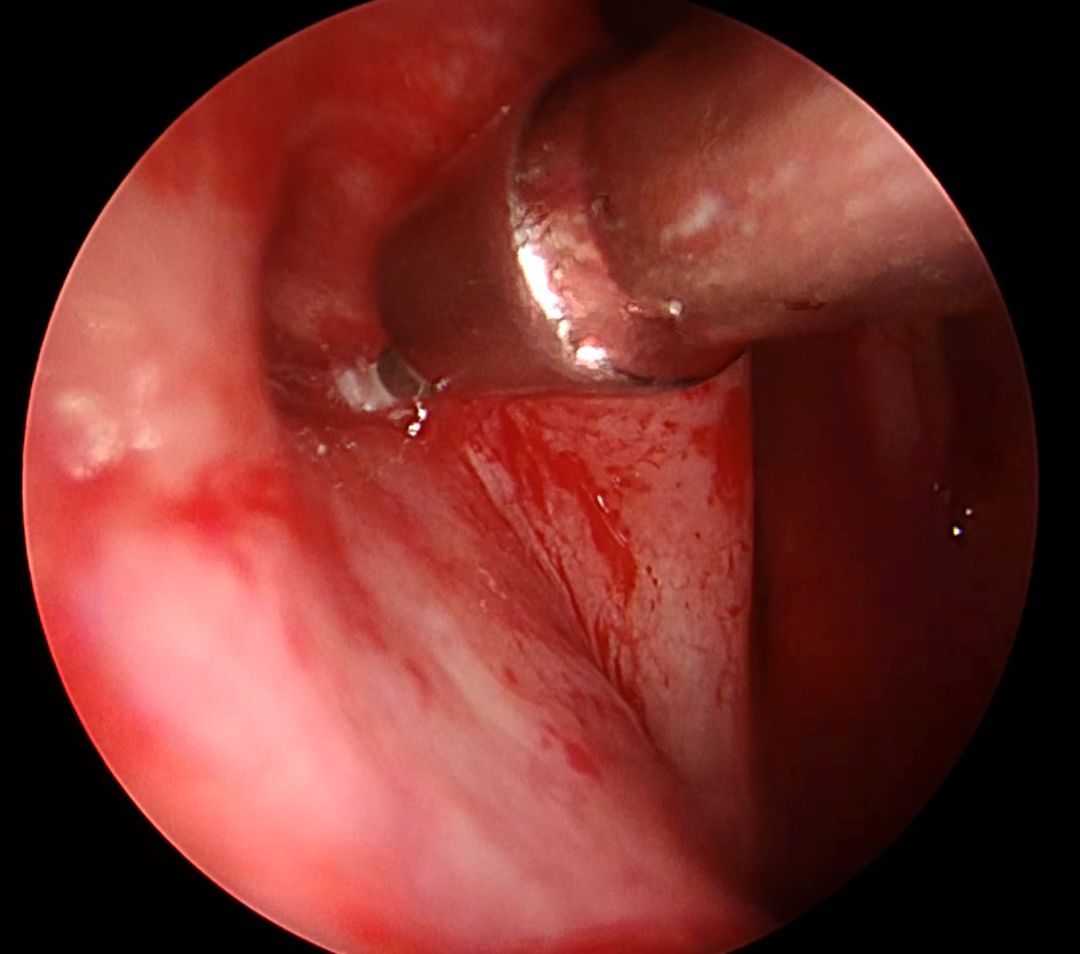 Zdjęcie z kamery operacyjnej.